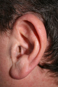 New Cosmetic Surgery Procedure to Reverse Stretched Earlobes-2593