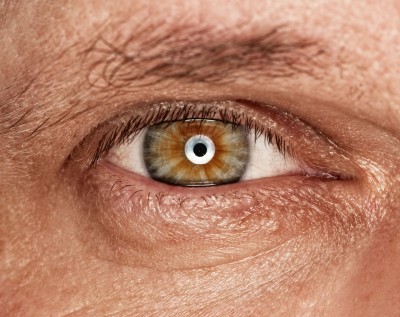 Could Stem Cell Research Help to Cure Blindness?-8701