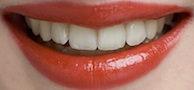 cosmetic dentistry guide