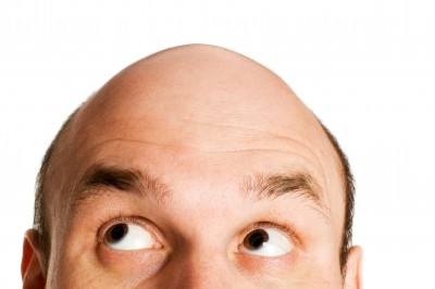 Is Hair loss Just Human Shedding? -0599