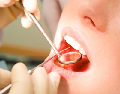 How is Oral Cancer Diagnosed?-4685