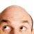 Is there A Link Between Age, Hair Loss and Prostate Cancer?-8451