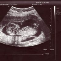 Potential Republican Presidential Candidate Likens Abortion To Slavery-9393