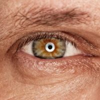 Worries over eye surgeon’s patients-1388