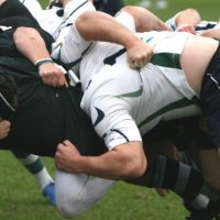 Sports Dentistry- What Is It?-8673