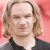 Can supplements really halt hair loss?-7950