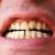 Shortage Of Patients For Dental Students-7547