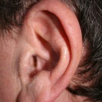 New Cosmetic Surgery Procedure to Reverse Stretched Earlobes-2593