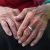 Dementia is the Most Common Cause of Death in England and Wales-4006