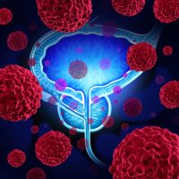 Prostate cancer deaths exceed breast cancer toll for the first time in the UK-9296