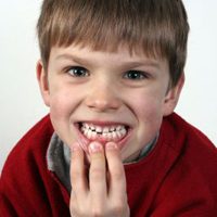 Dental Café: Focusing on preventing those harmful problems-3889