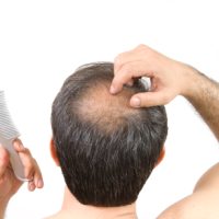 Losing hair an inspiration to start a new business-0961