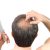 Losing hair an inspiration to start a new business-0961